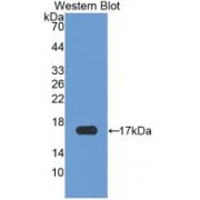 Western blot analysis of recombinant Human CHEM.