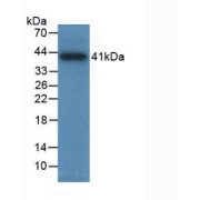 Western blot analysis of recombinant Human TPSAB1 (with N-terminal His and SUMO tags).
