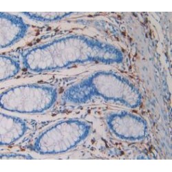 Tryptase Alpha / Beta-1 (TPSAB1) Antibody