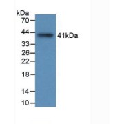 Western blot analysis of recombinant Human TPS (with N-terminal His and SUMO tags).