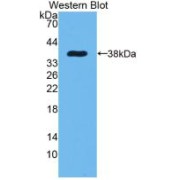 Western blot analysis of recombinant Rat EGF (with N-terminal His and GST tags).