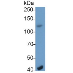 Epidermal Growth Factor (EGF) Antibody