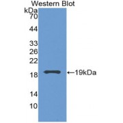 Western blot analysis of recombinant Human VEGFA.