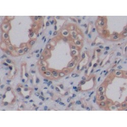 Vascular Endothelial Growth Factor A (VEGFA) Antibody