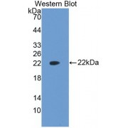 Western blot analysis of recombinant Rat VEGFA.