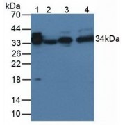 Western blot analysis of (1) Rat Serum Tissue, and (2) Rat Spleen Tissue, using Rabbit Anti-Rat aZGP1 Antibody (3 µg/ml) and HRP-conjugated Rabbit Anti-Mouse antibody (<a href="https://www.abbexa.com/index.php?route=product/search&amp;search=abx400002" target="_blank">abx400002</a>, 1:5000 dilution).