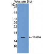 Western blot analysis of recombinant Human CAT.