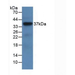 Leucine Rich Alpha-2-Glycoprotein 1 (LRG1) Antibody