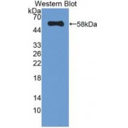 Western blot analysis of recombinant Human CAT.
