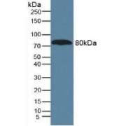 Western blot analysis of Human Serum.