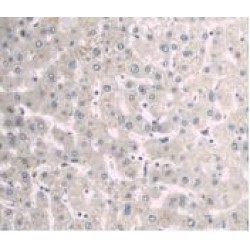 Alpha-1-B Glycoprotein (A1BG) Antibody