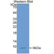 Western blot analysis of recombinant Human PLAC9.