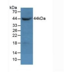 Beta Actin (ACTB) Antibody