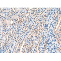 N-Terminal Pro-Atrial Natriuretic Peptide (NT-ProANP) Antibody