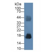 Western blot analysis of Human Urine, using Rabbit Anti-Human RNASE2 Antibody (1 µg/ml) and HRP-conjugated Goat Anti-Rabbit antibody (<a href="https://www.abbexa.com/index.php?route=product/search&amp;search=abx400043" target="_blank">abx400043</a>, 0.2 µg/ml).