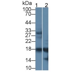 Ribonuclease A2 (RNASE2) Antibody