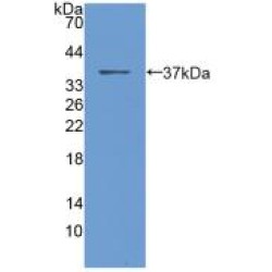 Procalcitonin (PCT) Antibody