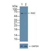 WB analysis of Lane 1: Wild-type A549 cell lysate, Lane 2: RHD knockout A549 cell lysate, using Human Blood Group RhD Polypeptide (RHD) Antibody (1 µg/ml) and HRP-conjugated Goat Anti-Rabbit antibody (0.2 µg/ml). Calculated MW: 34 kDa, 35 kDa, 42 kDa, 43 kDa, 45 kDa, 54 kDa and Observed MW: 58 kDa.