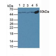 Western blot analysis of Rat Liver Tissue, Lane 2: Rat Kidney Tissue, Lane 3: Mouse Liver Tissue, Lane 4: Mouse Kidney Tissue, Lane 5: Mouse Brain Tissue.