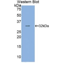 Tubulin Beta (TUBB) Antibody