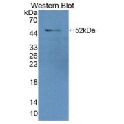 Western blot analysis of recombinant Human LMNA.