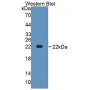 Western blot analysis of recombinant Human ATP1a1.
