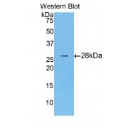 Western blot analysis of recombinant Human CTNNB1, using CTNNB1 antibody.