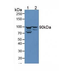Catenin Beta 1 (CTNNΒ1) Antibody