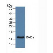 Western blot analysis of recombinant Rat Calcitonin.