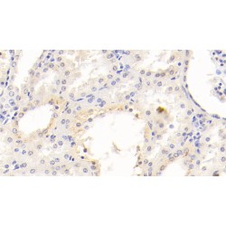 Hepatitis A Virus Cellular Receptor 1 (HAVCR1) Antibody