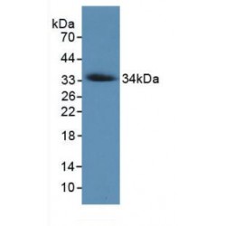 Collagen Type VII Alpha 1 (COL7A1) Antibody