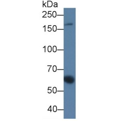 Alpha-2-Macroglobulin (A2M) Antibody