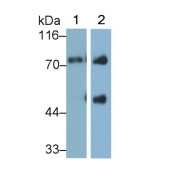 abx132626