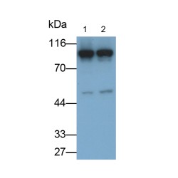 AMP Deaminase 2 (AMPD2) Antibody