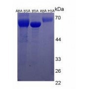 SDS-PAGE analysis of Abscisic Acid Protein (HSA).