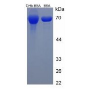 SDS-PAGE analysis of beta Hydroxybutyric Acid (BSA).