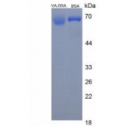 SDS-PAGE analysis of Vitamin A (BSA).