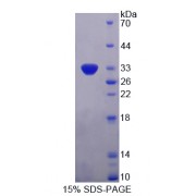 SDS-PAGE analysis of TTK Protein Kinase Protein.
