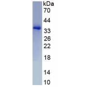 SDS-PAGE analysis of recombinant Human T-Box Protein 4 Protein.