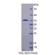 SDS-PAGE analysis of Ribosomal Protein S6 Kinase beta 1 Protein.