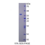 SDS-PAGE analysis of TAK1 Like Protein.