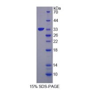 SDS-PAGE analysis of UBR4 Protein.