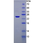 SDS-PAGE analysis of TAK1 Like Protein.