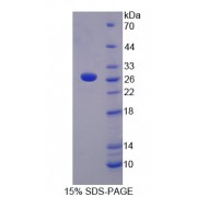 SDS-PAGE analysis of C-Reactive Protein.