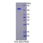 SDS-PAGE analysis of Ring Finger Protein 39 Protein.