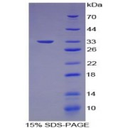 SDS-PAGE analysis of E1A Binding Protein P300 Protein.