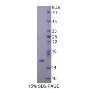 abx165925