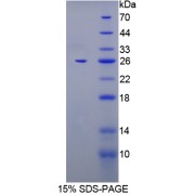 SDS-PAGE analysis of FK506 Binding Protein 7 Protein.