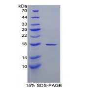 SDS-PAGE analysis of Retinol Binding Protein 1, Cellular Protein.