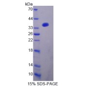 SDS-PAGE analysis of A Kinase Anchor Protein 12 Protein.